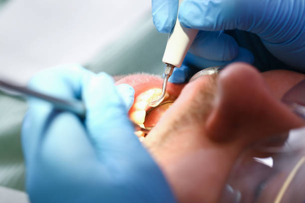 Best Walk-In Emergency Dentist in St Henry, OH